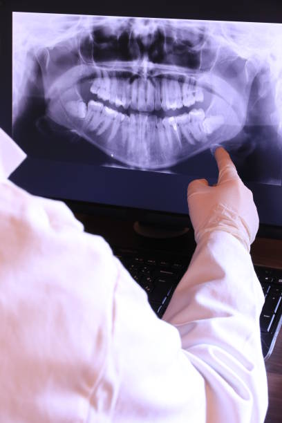 Best Chipped Tooth Repair Near Me  in Yalaha, FL